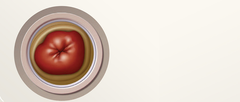 장(요)루의 클로즈업